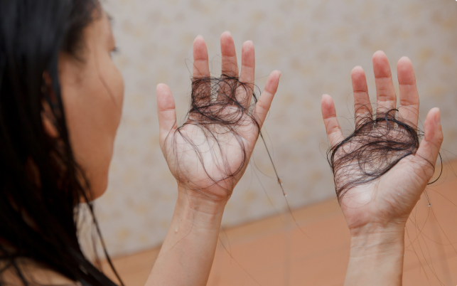 dream of hair falling out in clumps meaning